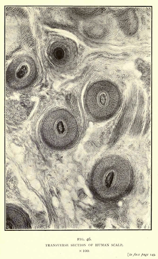 Illustration for article titled 110 Years Ago, These Microscopic Photos Horrified Londoners